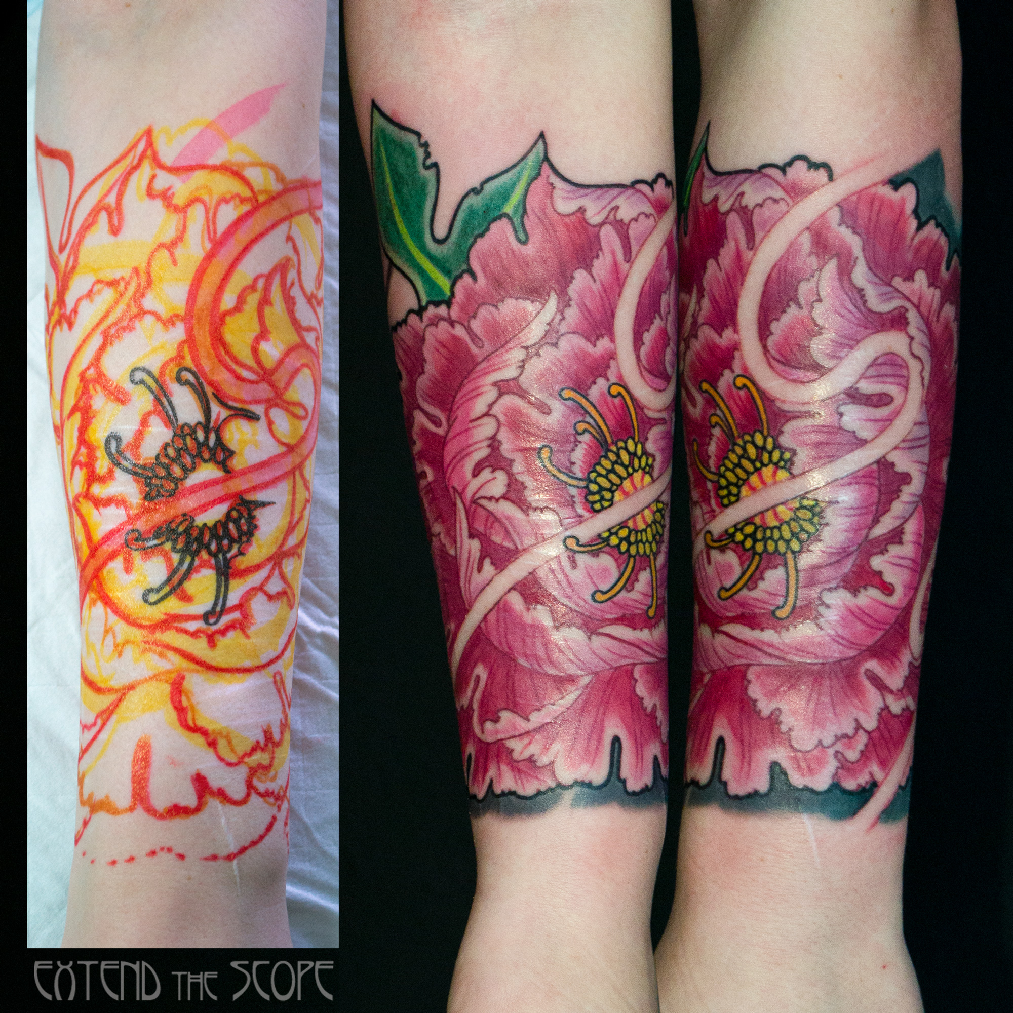 Blüte als Narbencover Scar-Cover-Up Narbentattoo Extend the Scope Göttingen