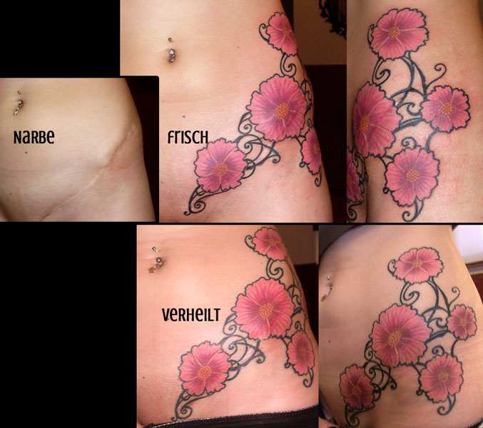 Blüten Narbencover Cover-Up-Tattoo Narbentattoo Extend the Scope Tattoo Göttingen